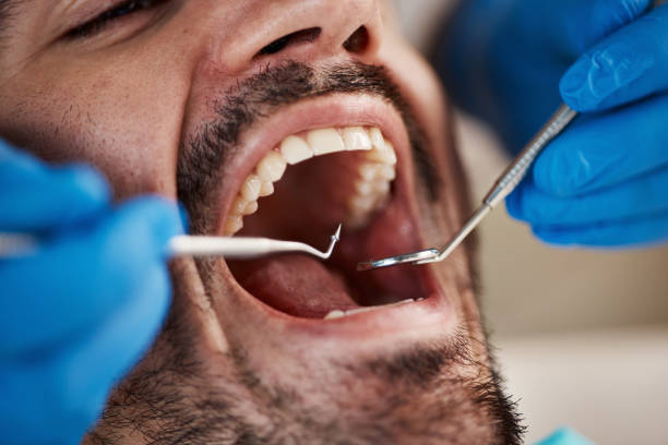 Best Emergency Dentist for Lost Fillings or Crowns in Tennille, GA
